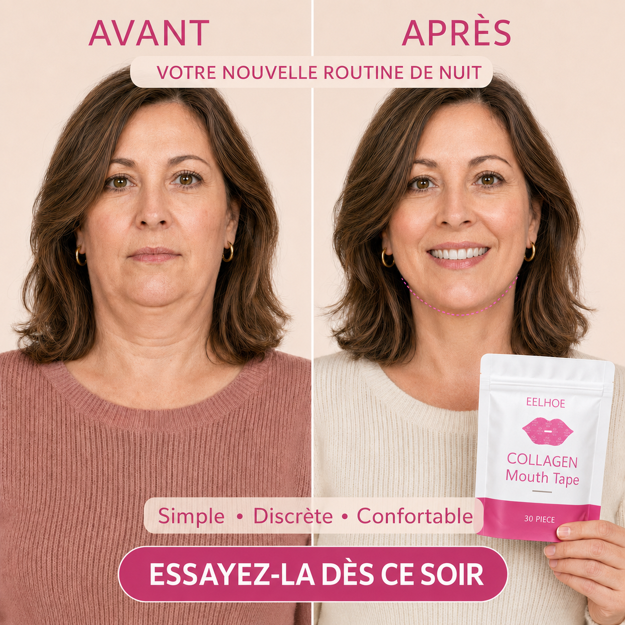 Bande buccale